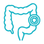 Enfermedad Inflamatoria Intestinal