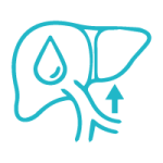 Hipertensión Portal
